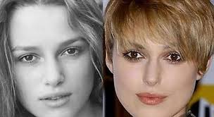 keira knightley plastic surgery Keira Knightley Plastic Surgery Before and After