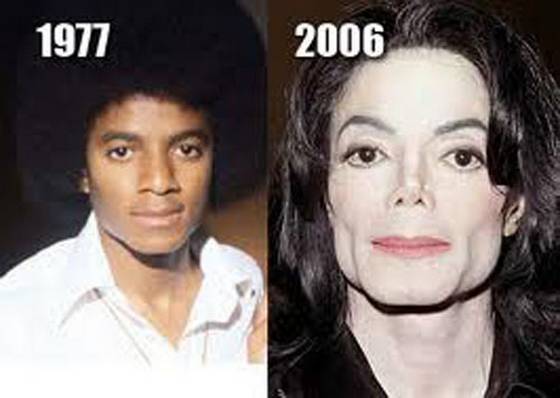 michael jackson plastic surgery before and after Michael Jackson Plastic Surgery Before and After