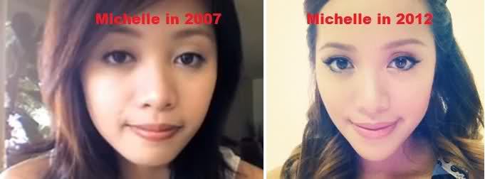 michelle phan plastic surgery Michelle Phan Plastic Surgery Before and After