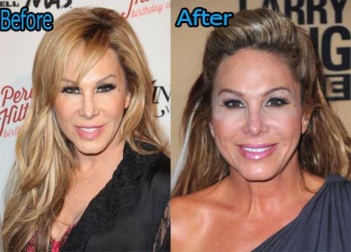 Adrienne Maloof Plastic Surgery Before and After Pictures Adrienne Maloof Plastic Surgery Before After