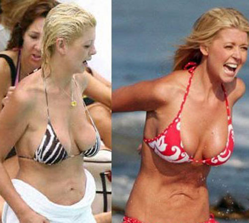 Tara Reid Plastic Surgery Before and After Tara Reid Plastic Surgery Before and After