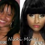 Has Nicki Minaj Had Plastic Surgery ?