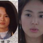 Song Hye Kyo Plastic Surgery Before and After