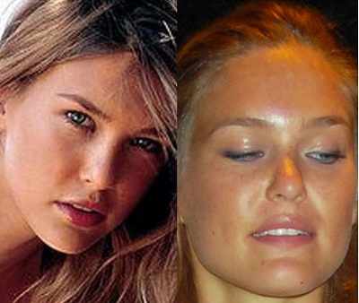 Bar Refaeli Plastic Surgery Before and After Has Bar Refaeli Had Plastic Surgery ?