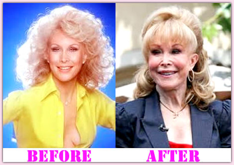 Barbara Eden Before and After Plastic Surgery