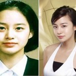 Has The Plastic Surgery Become The “Part” of Kim Tae Hee Life?