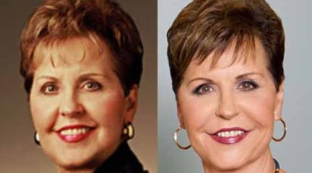 Joyce Meyer Plastic Surgery Before and After 450x250 Did Joyce Meyer Have a Plastic Surgery?