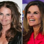 Maria Shriver Plastic Surgery Before and After