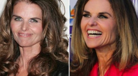 Maria Shriver Plastic Surgery Before and After 450x250 Maria Shriver Plastic Surgery Before and After