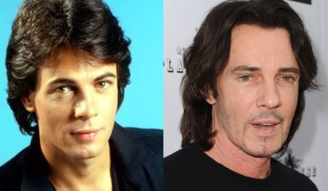 Rick Springfield Plastic Surgery Before and After The Story of Rick Springf...
